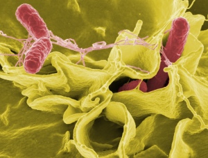 Typhoid Bacteria Image