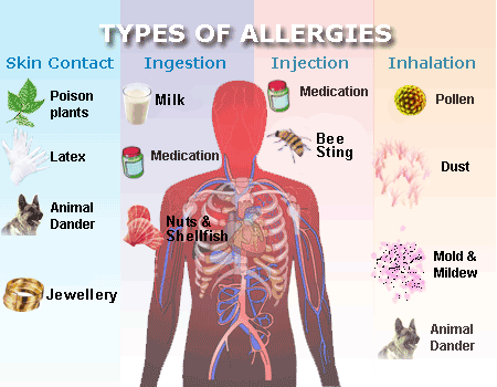 types of allergies and homeopathic treatment